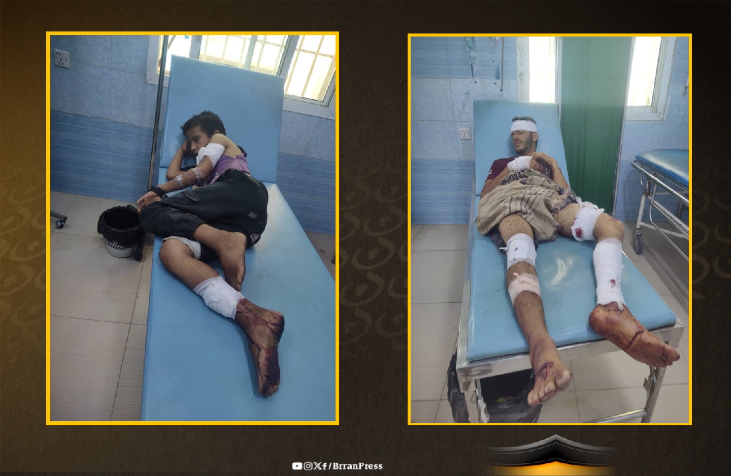 إصابات متفاوتة لشقيقين بانفجار عبوة ناسفة - تعز إصابات متفاوتة لشقيقين بانفجار عبوة ناسفة - تعز