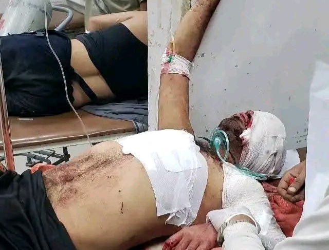 جرحى نتيجة استهداف الحوثيين محطة وقود في تعز